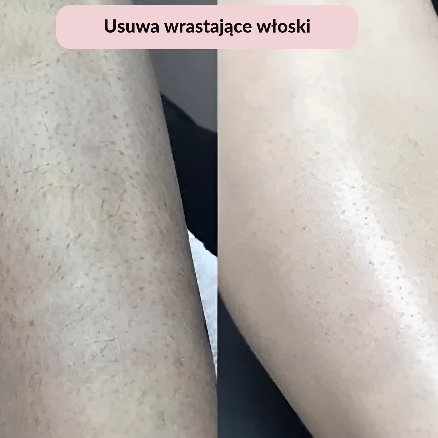 Golarka Noom™ 2w1 - Błyskawicznie Gładka Skóra – Zero Podrażnień