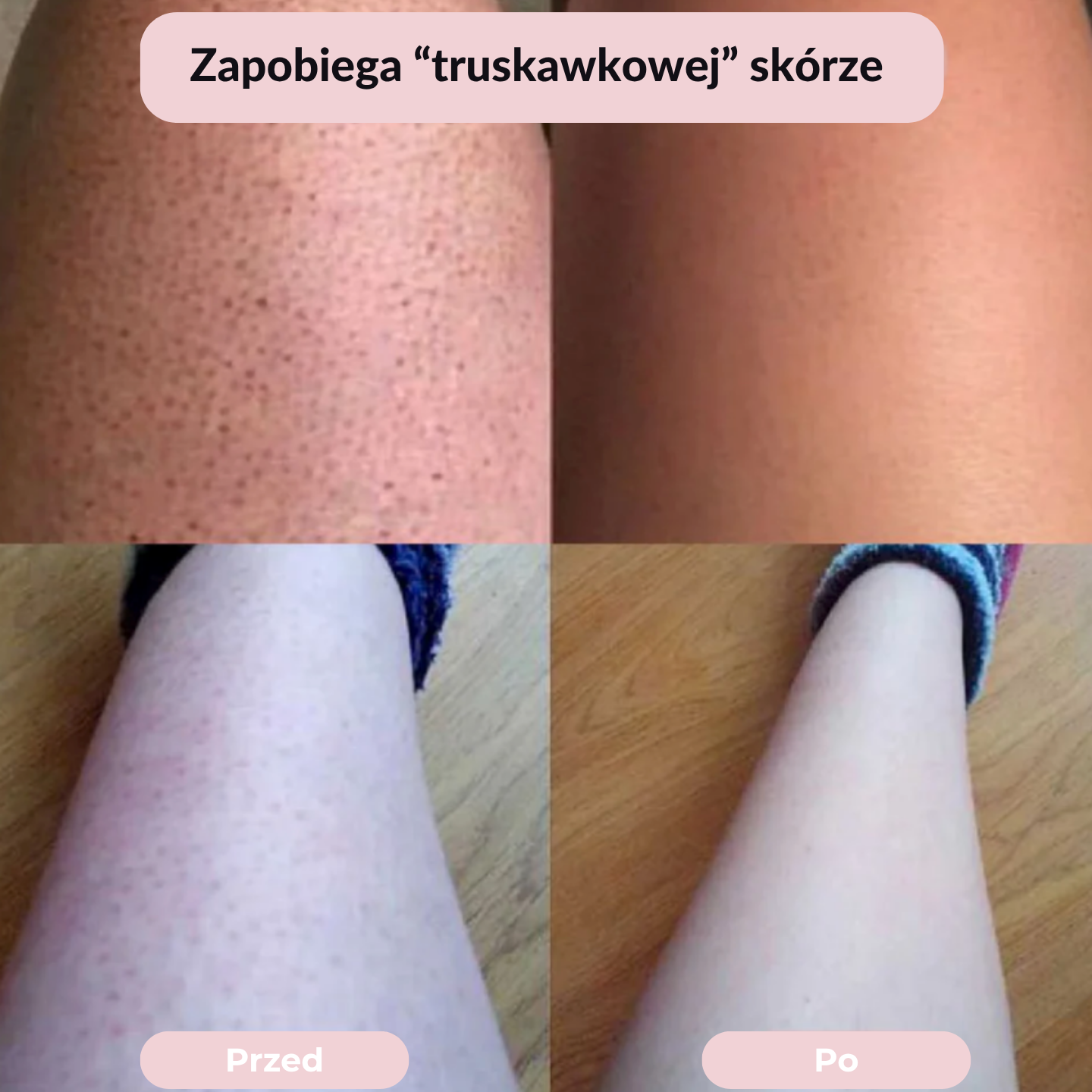 Golarka Noom™ 2w1 - Błyskawicznie Gładka Skóra – Zero Podrażnień