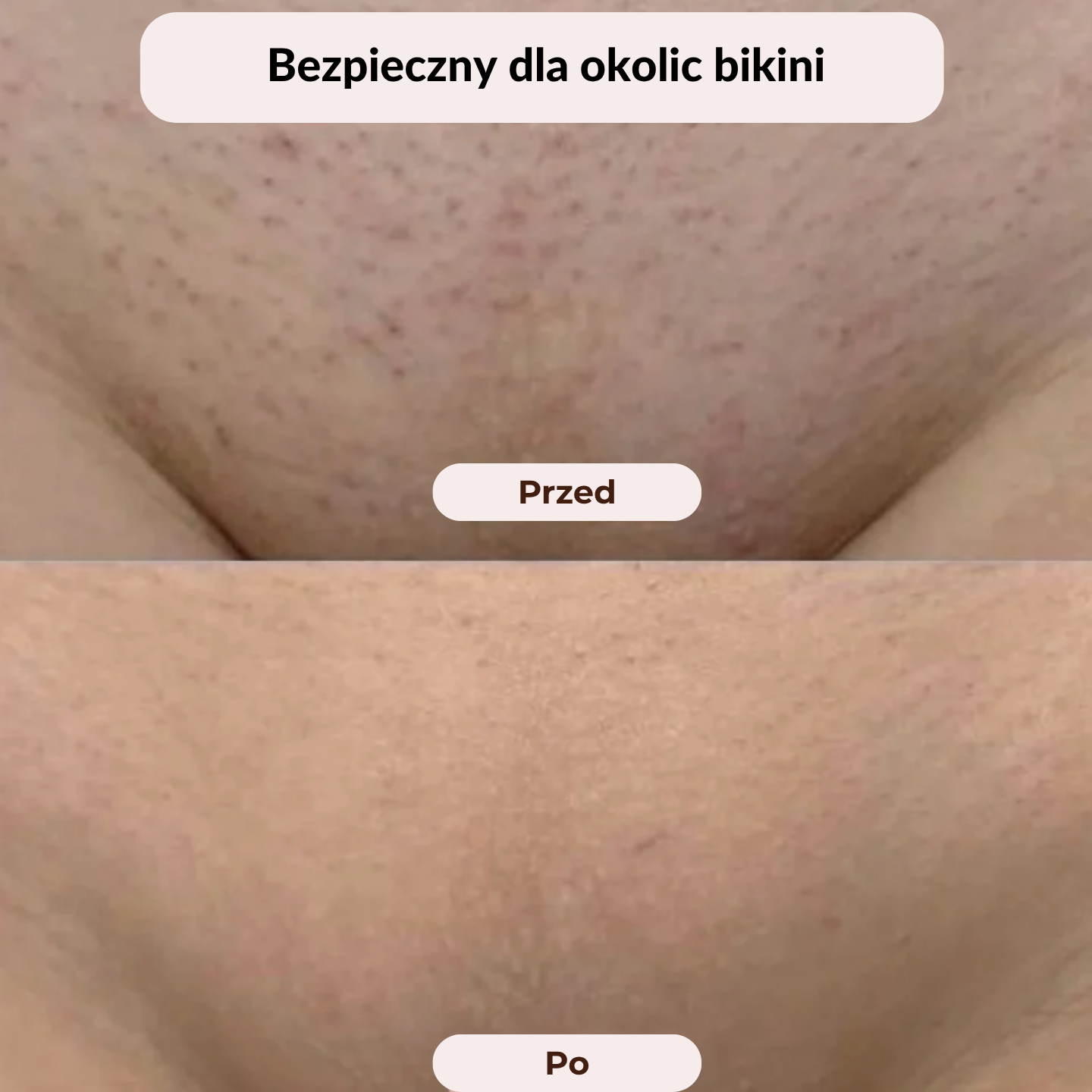 Golarka Noom™ 2w1 - Błyskawicznie Gładka Skóra – Zero Podrażnień