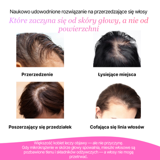 Masażer skóry włosów i głowy z technologią LED Noom™