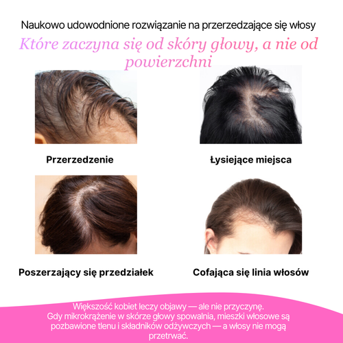 Masażer skóry włosów i głowy z technologią LED Noom™