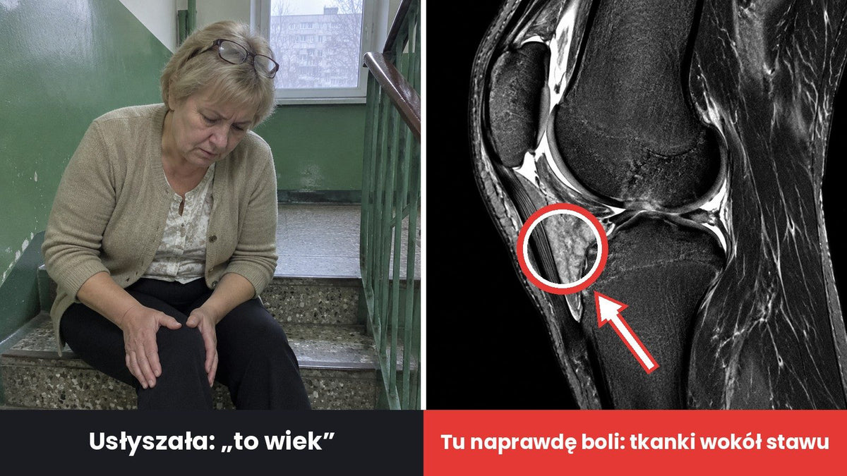 Kobieta po sześćdziesiątce siedzi na schodach w bloku i trzyma się za kolano, podpis „Usłyszała: „to wiek””; obok rezonans kolana z czerwonym kółkiem i strzałką, podpis „Tu naprawdę boli: tkanki wokół stawu”.