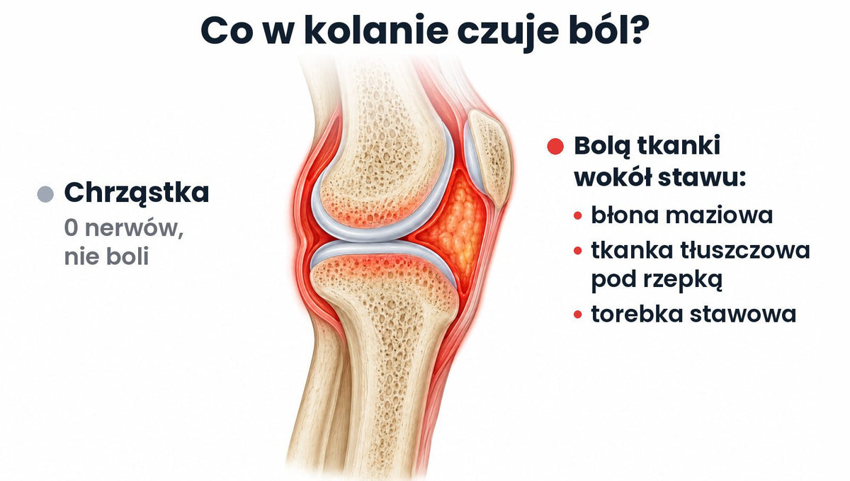 Przekrój kolana z boku: szara chrząstka (0 nerwów, nie boli) i na czerwono tkanki, które bolą: błona maziowa, tkanka tłuszczowa pod rzepką, torebka stawowa.