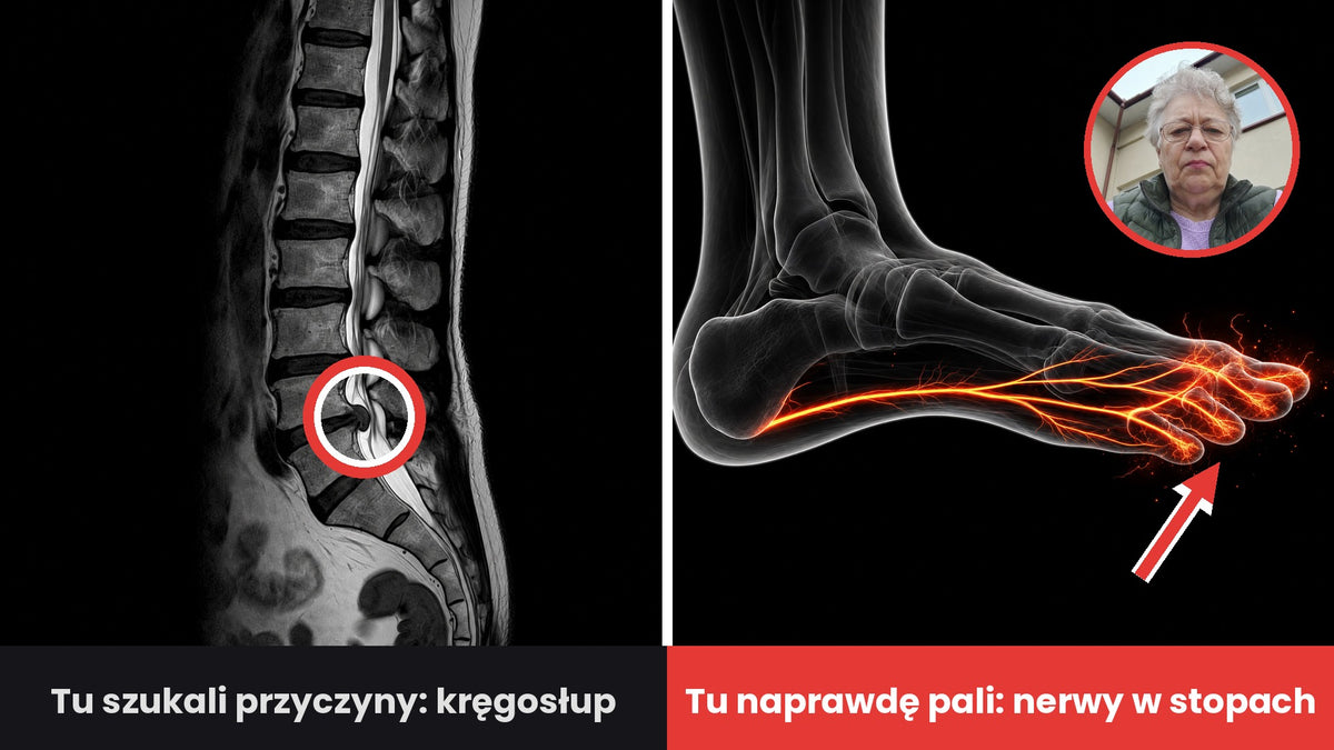 Po lewej rezonans kręgosłupa z zaznaczonym miejscem („Tu szukali przyczyny: kręgosłup”), po prawej stopa z płonącymi nerwami („Tu naprawdę pali: nerwy w stopach”), w kółku portret starszej kobiety