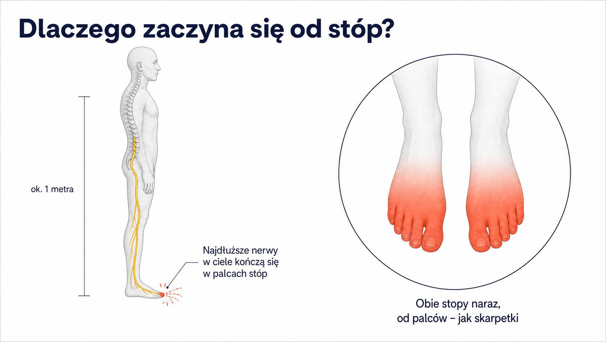 Infografika: nerw od kręgosłupa do palca stopy ma około metra; objawy zaczynają się od palców obu stóp