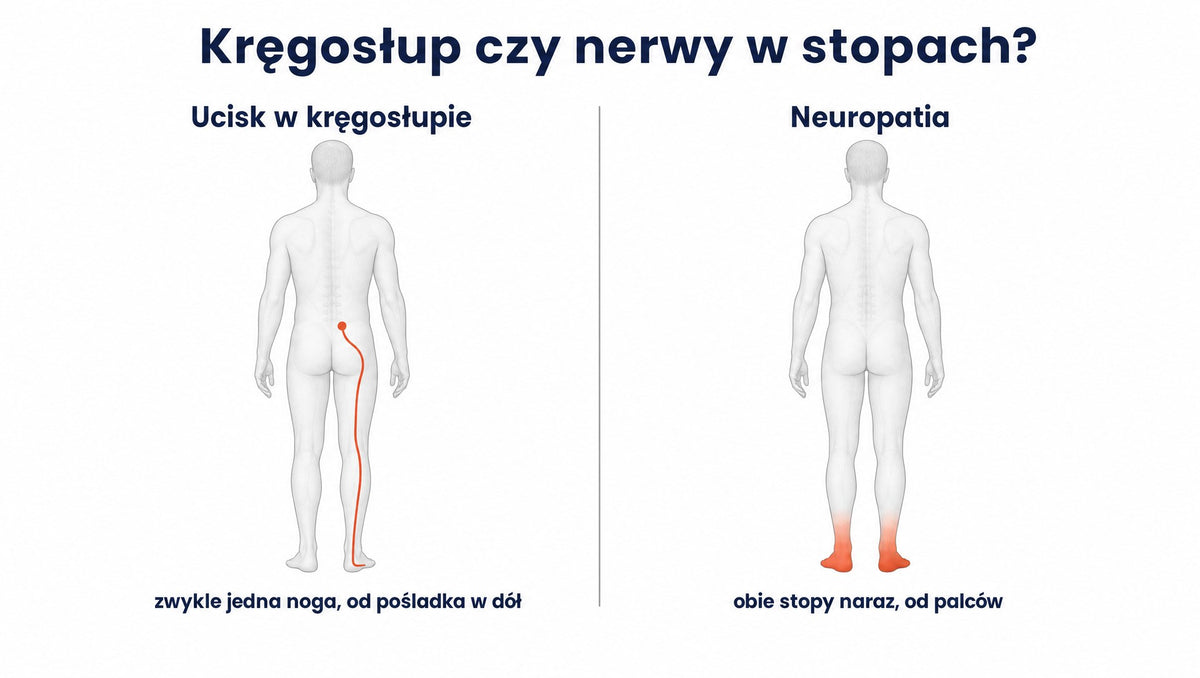 Infografika: ucisk w kręgosłupie daje objawy w jednej nodze, neuropatia w obu stopach od palców